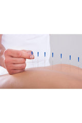 Akupunktur iğnesikuru iğne,acupuncture needle 0.20*13mm