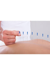 Akupunktur iğnesikuru iğne,acupuncture needle 0,30*40mm