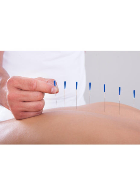Akupunktur Iğnesikuru Iğne,acupuncture Needle 0.30*50mm