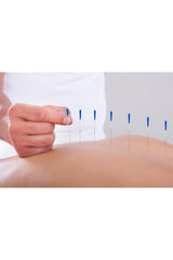 Akupunktur iğnesikuru iğne,acupuncture needle 0,18*7mm