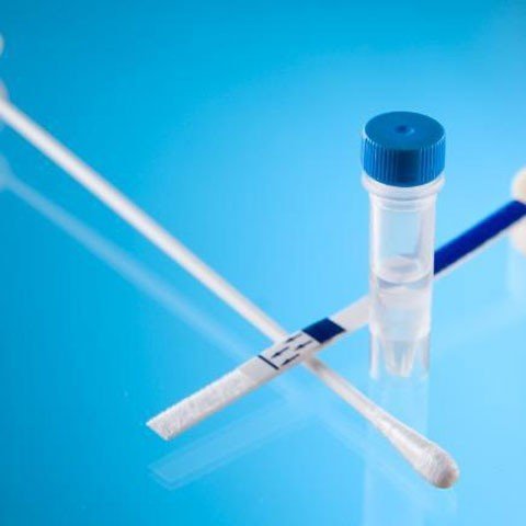 Amnisure fetal membran yırtığı testi