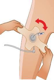 AngioPad Kasık Kapama Pedi