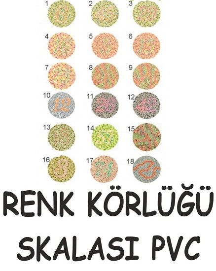 Renk körlüğü skalası