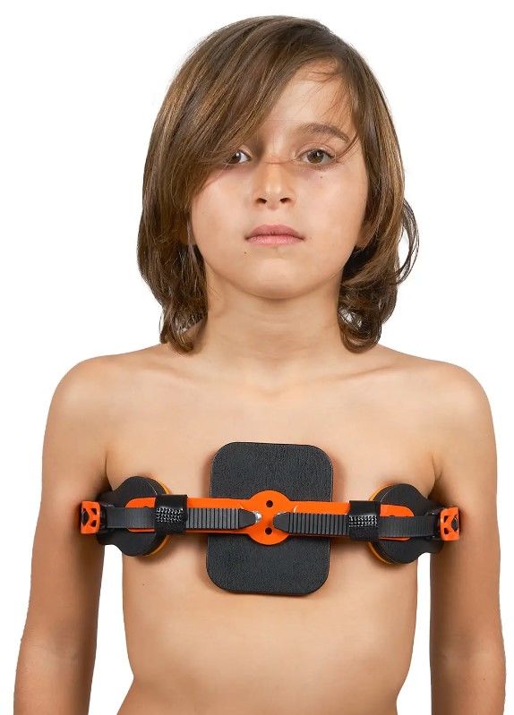 Medkaltec Wp953 pectus carinatum ortezi dinamik